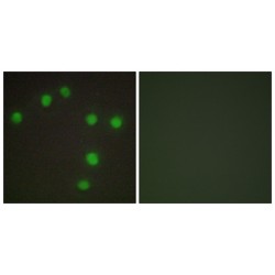 Homeobox Protein Nkx-6.3 (NKX6.3) Antibody