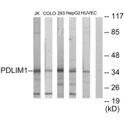 Western blot analysis of extracts from Jurkat cells, COLO205 cells, 293 cells, HepG2 cells and HUVEC cells, using PDLIM1 antibody.
