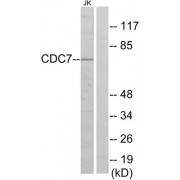 Western blot analysis of extracts from Jurkat cells, using CDC7 antibody.