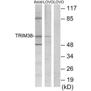 Western blot analysis of extracts from RAW264.7 cells and LOVO cells, using TRIM38 antibody.