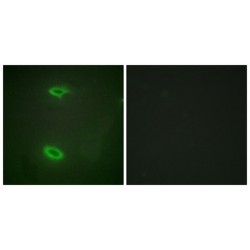 Disks Large-Associated Protein 1 (DLGP1) Antibody