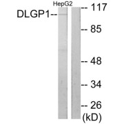 Western blot analysis of extracts from HepG2 cells, using DLGP1 antibody. The lane on the right is blocked with the synthesized peptide.