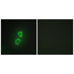 Tumor Necrosis Factor Ligand Superfamily Member 11 / RANKL (TNFSF11) Antibody