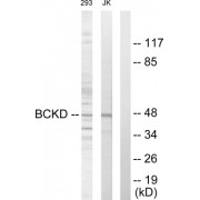 Western blot analysis of extracts from 293 cells and Jurkat cells, using BCKD antibody.