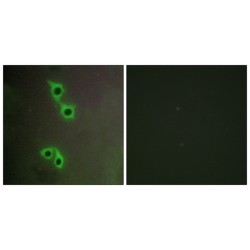 Microtubule Associated Serine/threonine Kinase Family Member 4 (MAST4) Antibody