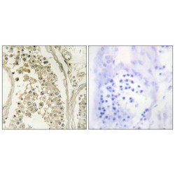 Microtubule Associated Serine/threonine Kinase Family Member 4 (MAST4) Antibody