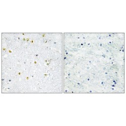 Tripartite Motif-Containing 24 (TRIM24) Antibody
