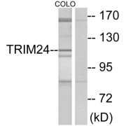 Western blot analysis of extracts from COLO cells, using TRIM24 antibody.