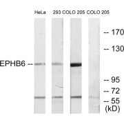 Western blot analysis of extracts from HeLa cells, 293 cells and COLO cells, using EPHB6 antibody.