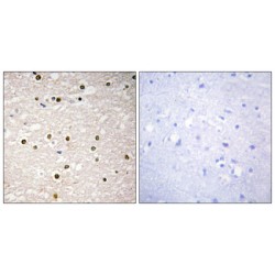 Tumor Protein P73 (p73) Antibody