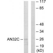 Western blot analysis of extracts from HUVEC cells, using AN32C antibody.