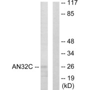 Western blot analysis of extracts from HUVEC cells, using AN32C antibody.