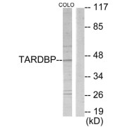 Western blot analysis of extracts from COLO205 cells, using TBX1 antibody.