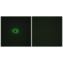 Tumor Necrosis Factor Ligand Superfamily Member 12 (TNF12) Antibody