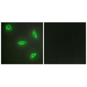 Immunofluorescence analysis of HeLa cells, using TNF14 antibody.
