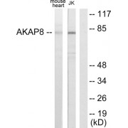 Western blot analysis of extracts from mouse heart cells and Jurkat cells, using AKAP8 antibody.