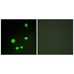 Mediator Complex Subunit 14 (MED14) Antibody
