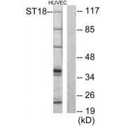 Western blot analysis of extracts from HUVEC cells, using ZNF387 antibody.