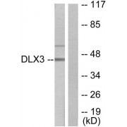 Western blot analysis of extracts from 293 cells, using DLX3 antibody.