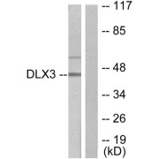 Western blot analysis of extracts from 293 cells, using DLX3 antibody.