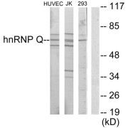 Western blot analysis of extracts from HUVEC cells, Jurkat cells and 293 cells, using hnRNP Q antibody.
