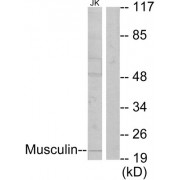 Western blot analysis of extracts from Jurkat cells, using Musculin antibody.