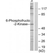 Western blot analysis of extracts from Jurkat cells, using PFKFB2 antibody.