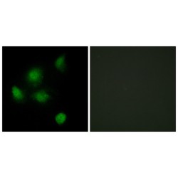 SIN3 Transcription Regulator Family Member B (SIN3B) Antibody