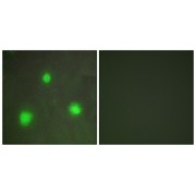 Immunofluorescence analysis of A549 cells, using FOXH1 antibody.