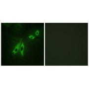 Immunofluorescence analysis of NIH/3T3 cells, using AKAP3 antibody.