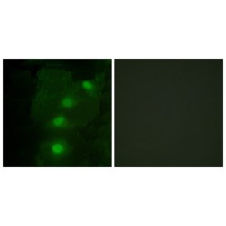 ALX Homeobox 3 (ALX3) Antibody