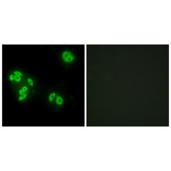 Tumor Necrosis Factor Alpha-Induced Protein 8 (TFIP8) Antibody