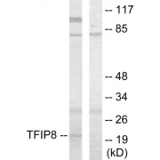 Western blot analysis of extracts from HUVEC cells, using TFIP8 antibody.