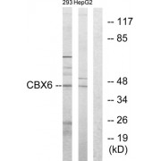 Western blot analysis of extracts from 293 cells and HepG2 cells, using CBX6 antibody.