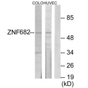 Western blot analysis of extracts from COLO205 cells and HUVEC cells, using ZNF682 antibody.