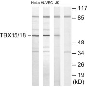 Western blot analysis of extracts from HeLa cells, HUVEC cells and Jurkat cells, using TBX15/18 antibody.