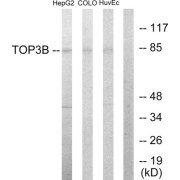 Western blot analysis of extracts from HepG2 cells, COLO205 cells and HUVEC cells, using TOP3B antibody.