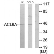 Western blot analysis of extracts from Jurkat cells and COLO205 cells, using ACL6A antibody.