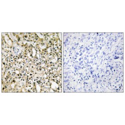 Myc Proto-Oncogene Protein (MYC) Antibody