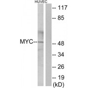 Western blot analysis of extracts from HUVEC cells, using Myc antibody.