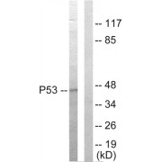 Western blot analysis of extracts from HepG2 cells, using p53 antibody.