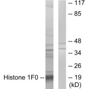 Western blot analysis of extracts from A549 cells, using Histone 1F0 antibody.