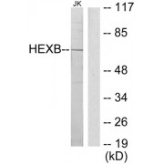 Western blot analysis of extracts from Jurkat cells, using HEXB antibody.