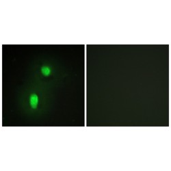 hnRNP C1 / C2 Antibody