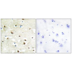 hnRNP C1 / C2 Antibody