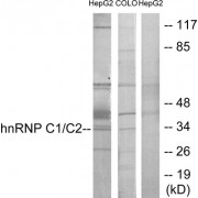 Western blot analysis of extracts from HepG2 cells and COLO205 cells, using hnRNP C1/C2 antibody.