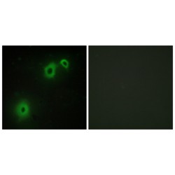Tumor Necrosis Factor Receptor Superfamily Member 16 (TNR16) Antibody
