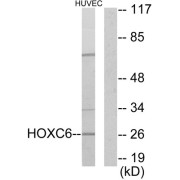 Western blot analysis of extracts from HUVEC cells, using HOXC6 antibody.