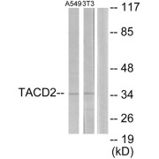 Western blot analysis of extracts from A549 cells and NIH-3T3 cells, using TACD2 antibody.