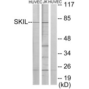 Western blot analysis of extracts from HUVEC cells and Jurkat cells, using SKIL antibody.